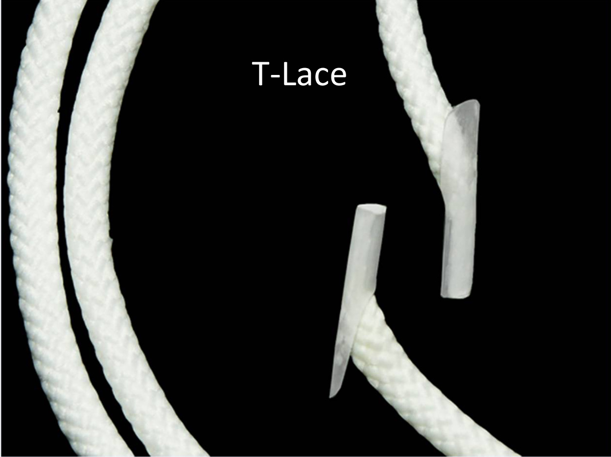 T-Lace.jpg