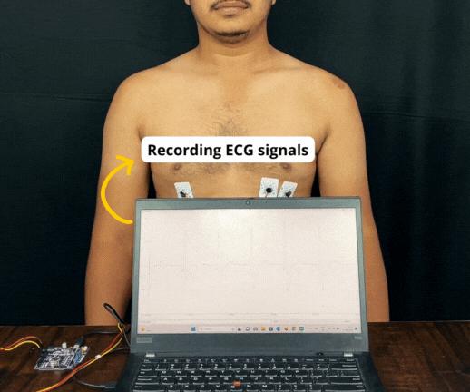 Record Publication Grade ECG at Your Home Using BioAmp EXG Pill