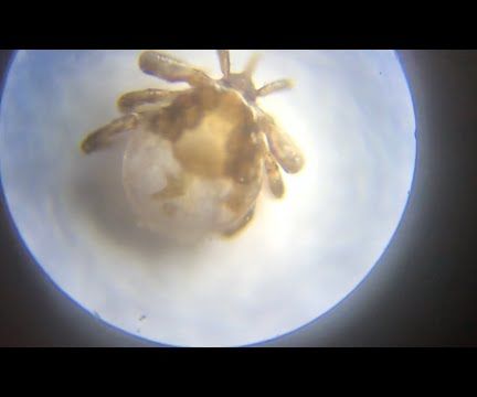 How SMALL Are Deer Ticks and How to PROTECT Ourselves From Them (lyme Disease)