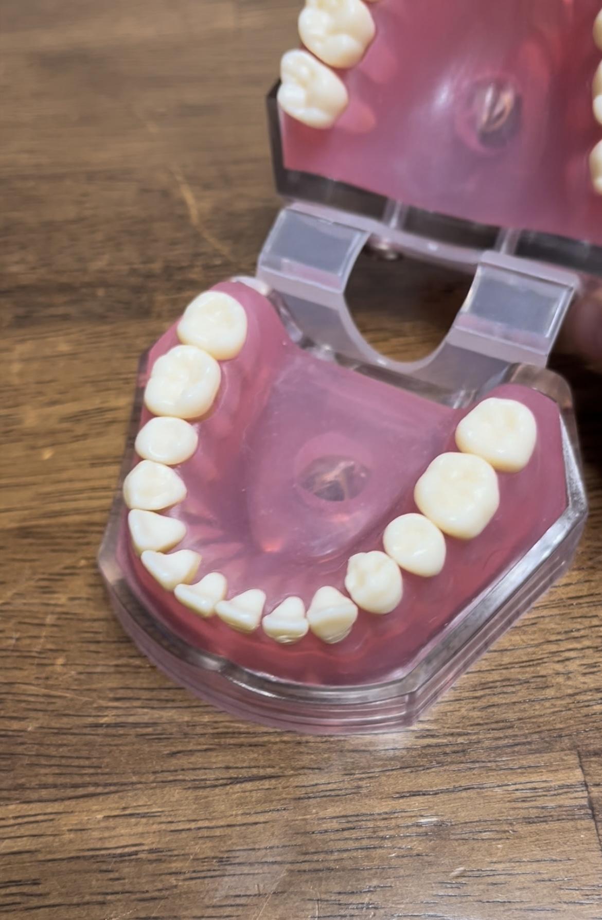 A Mistake You Are Making by Not Flossing 