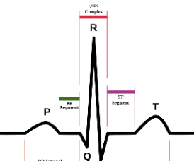 Designing a Functional ECG With Arduino Output