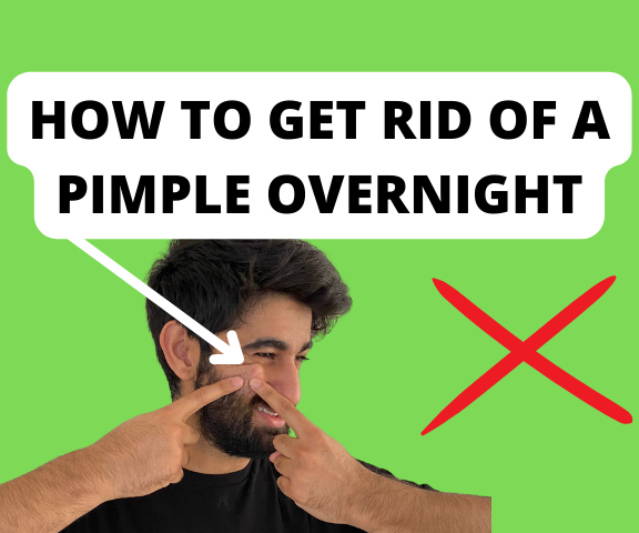 How to Get Rid of a Pimple Overnight