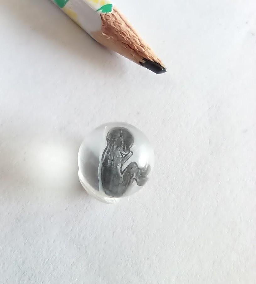 Life in Your Hand: Tiny Foetus in 9 Mm Pearl